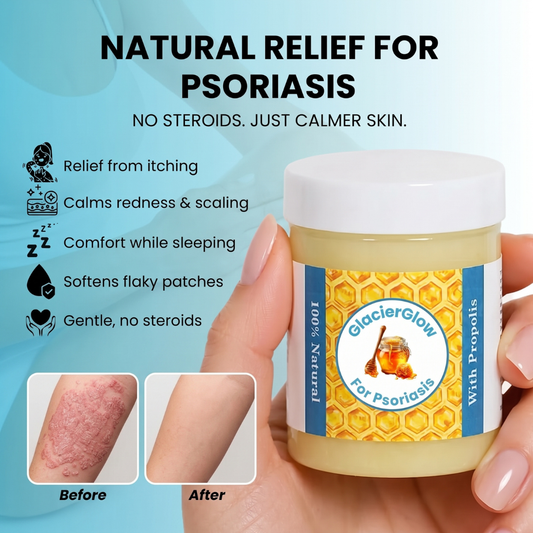 GlacierGlow - Repair Balm For Psoriasis